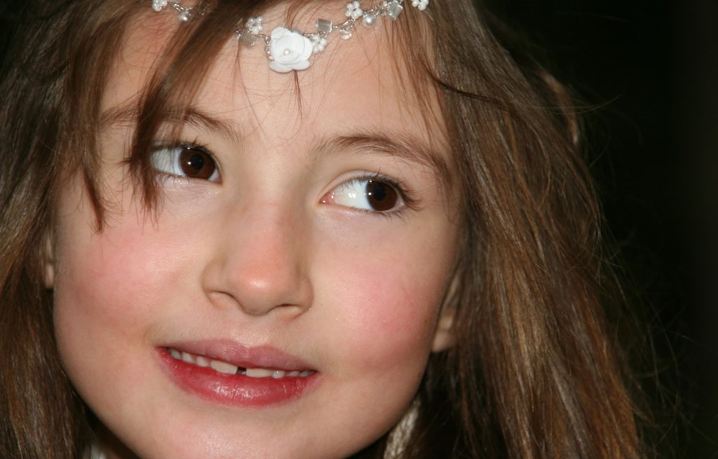 denti da latte che non cadono